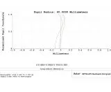Askar 80PHQ 80mm 600mm f/7,5 Quadruplet Flatfield Super APO Astrograph