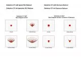 Starizona 0.63x SCTCORRECTOR - IV Reducer fr Schmidt Cassegrain Teleskope