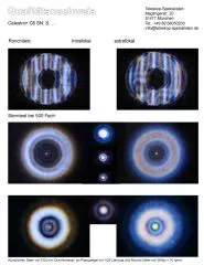 Qualittsnachweis mit Sterntest und Ronchi fr einen Celestron C6 SC XLT - 150/1500mm Schmidt Cassegrain
