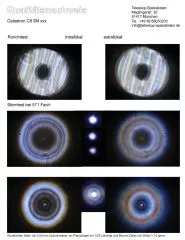 Sterntest und Ronchi fr ein Celestron C8